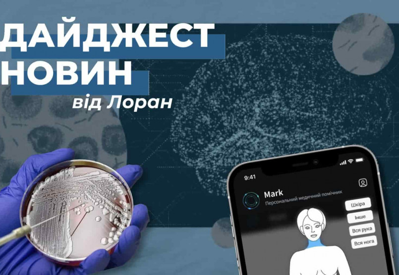 Дайджест новин за травень від Лоран